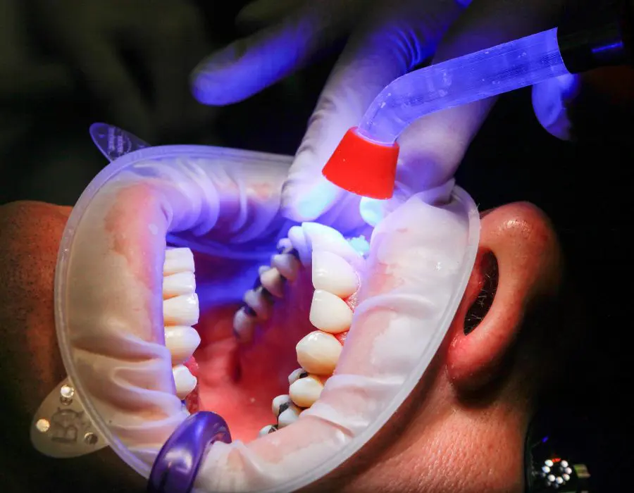 Man at the dentist getting a tooth filling