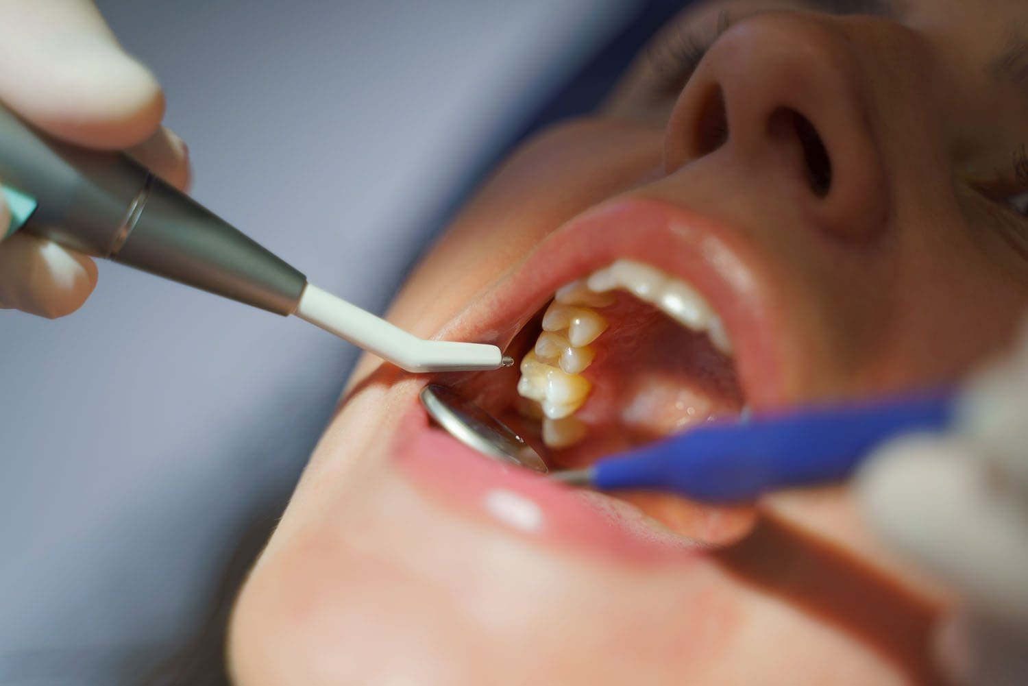 Close-up of dental examination