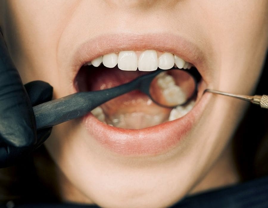 Person at the dentist office with dental tools in their mouth getting periodontal treatment