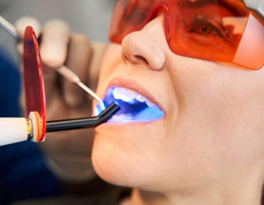 Person getting amalgam fillings at the dentist Person getting amalgam fillings at the dentist