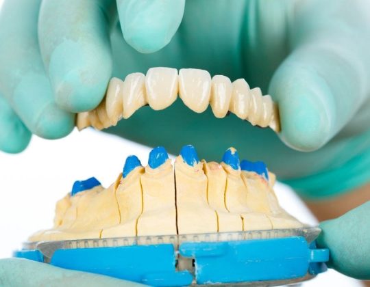 An example showing a dentist holding a dental bridge, showing what it looks like. It can be removable for the client's convenience.