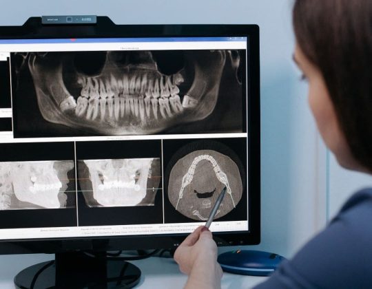 Woman dental assistant looking over a patient's teeth xrays.