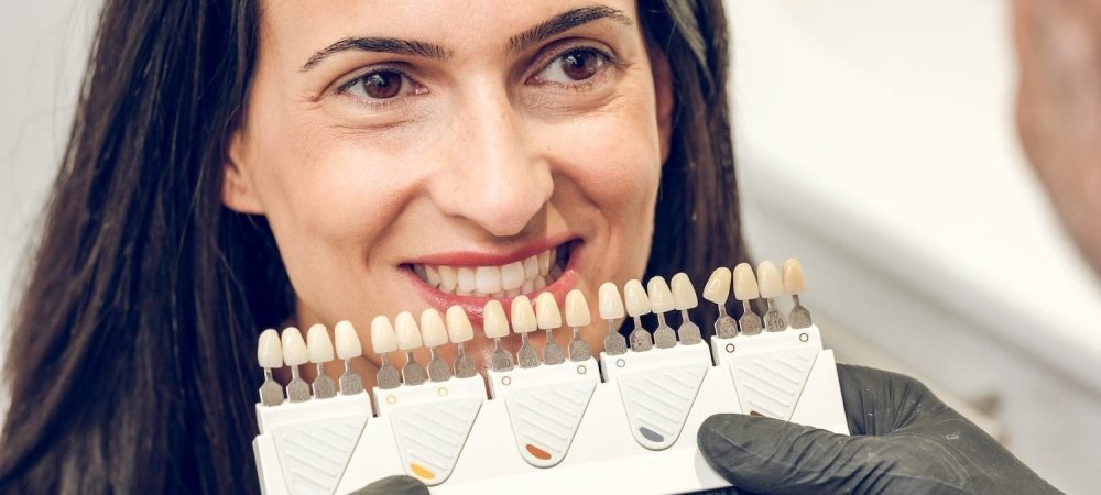 Choosing color of teeth from shade guide preparing for whitening procedure at Byrne Dental