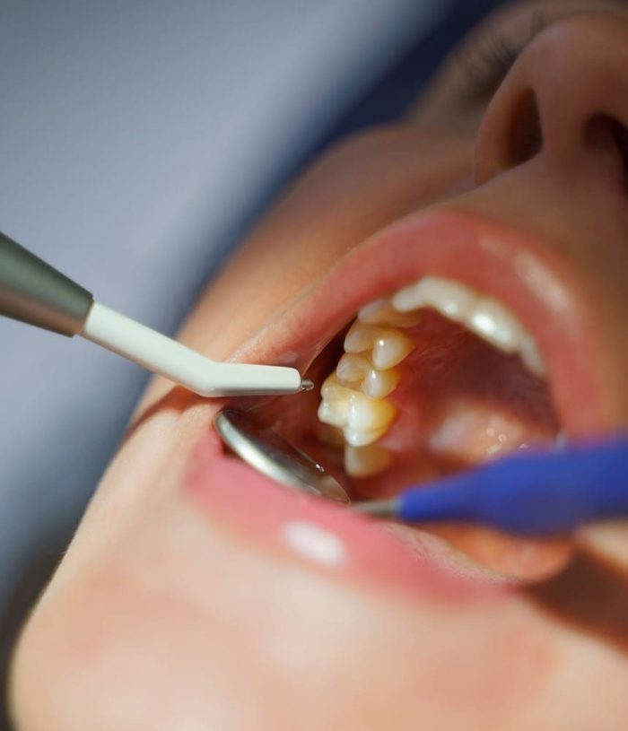Close-up of dental examination