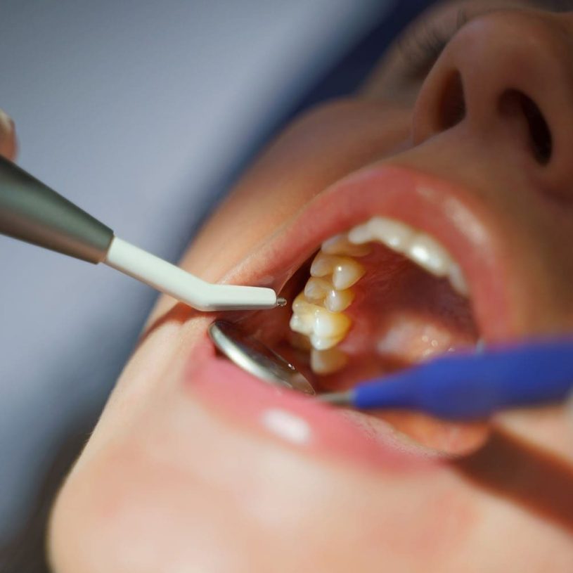 Close-up of dental examination