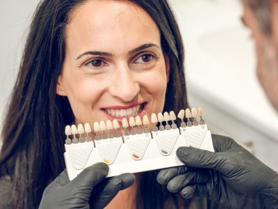 Choosing color of teeth from shade guide preparing for whitening procedure at Byrne Dental