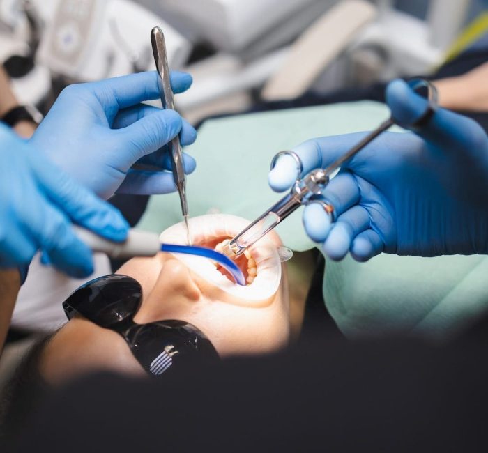 Dental patient getting a Root Canal at Byrne Dental in Rapid City, SD