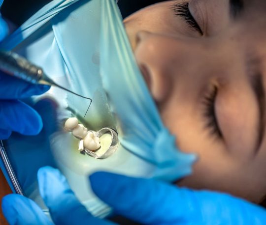 child getting tooth pulled